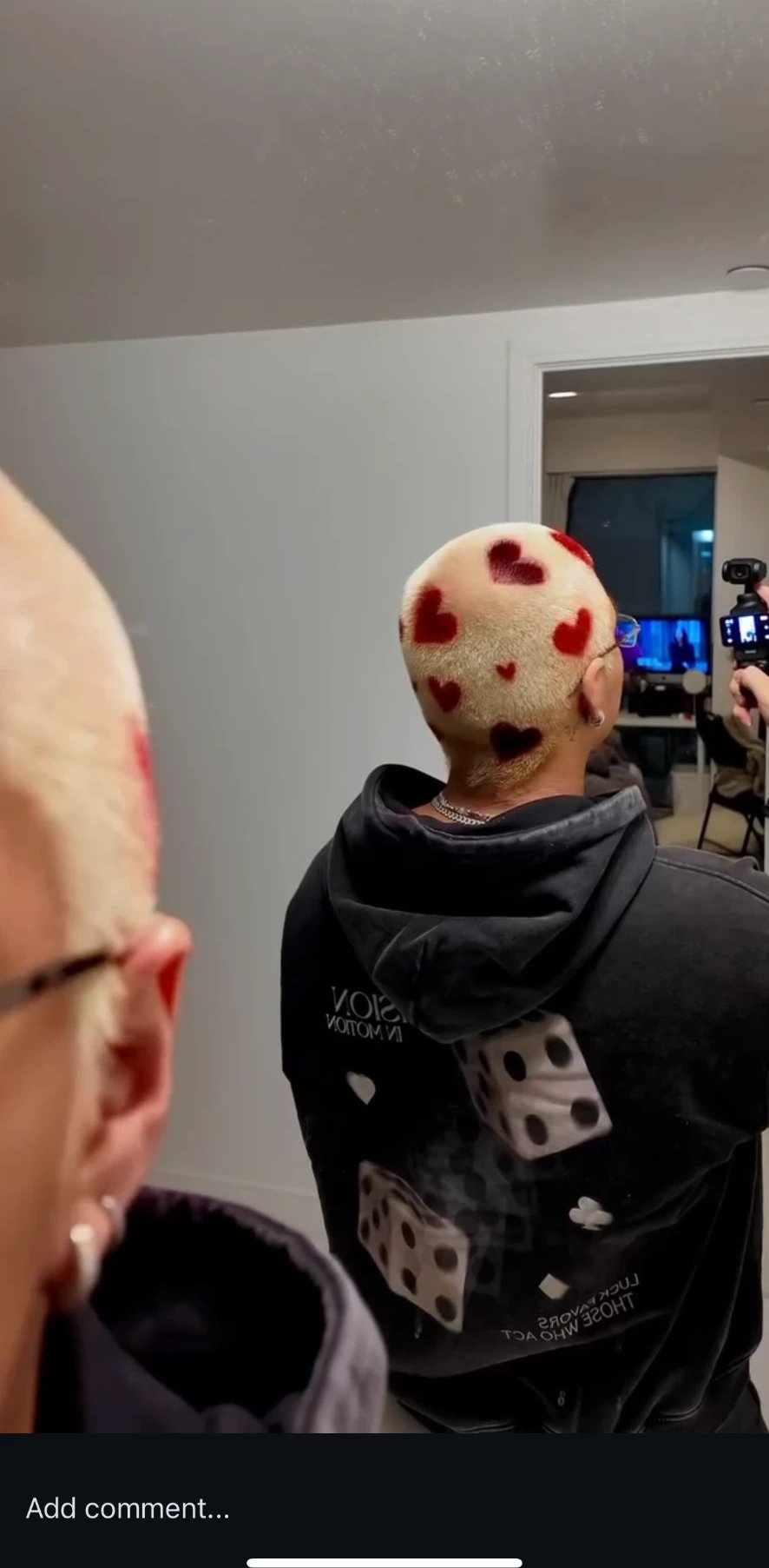 Red heart designs coloured into a platinum buzz cut